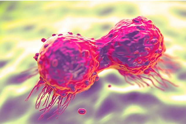 40 people diagnosed with cancer every minute – WHO