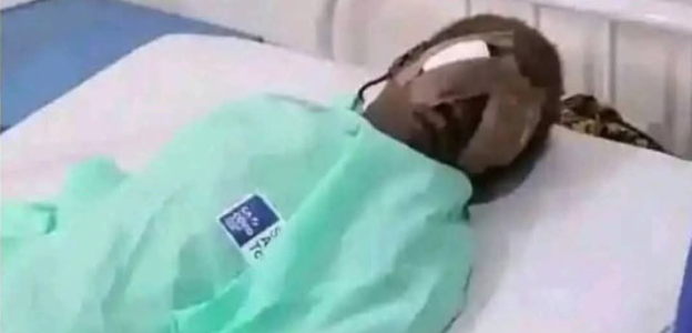 17-yr-old boy removes sister’s eyes for money ritual in Bauchi